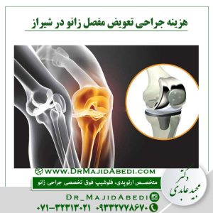 Read more about the article هزینه جراحی تعویض مفصل زانو در شیراز