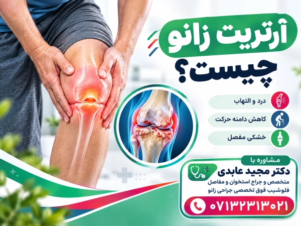 آرتریت زانو