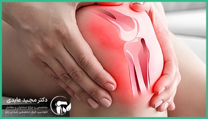 آرتروز زانو در چه کسانی شایع است؟