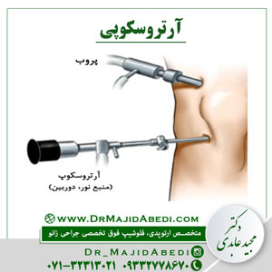 Read more about the article آرتروسکوپی در شیراز