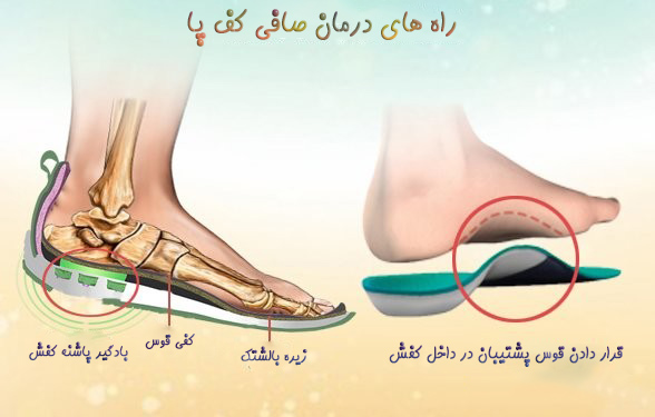 راه های درمان کف پای صاف - دکتر مجید عابدی، متخصص ارتوپدی