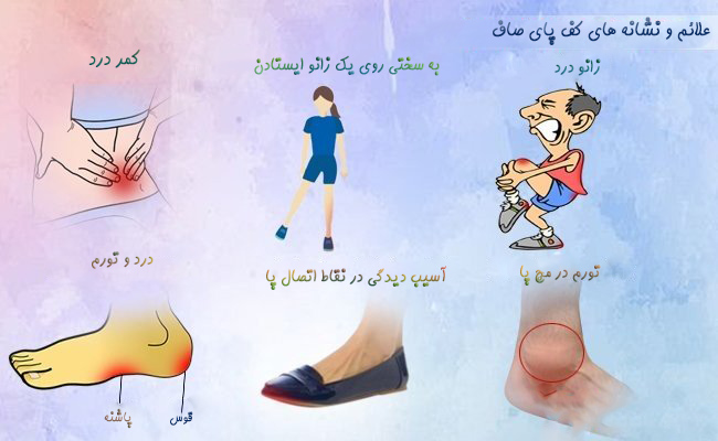علائم و نشانه های صافی کف پا - دکتر مجید عابدی
