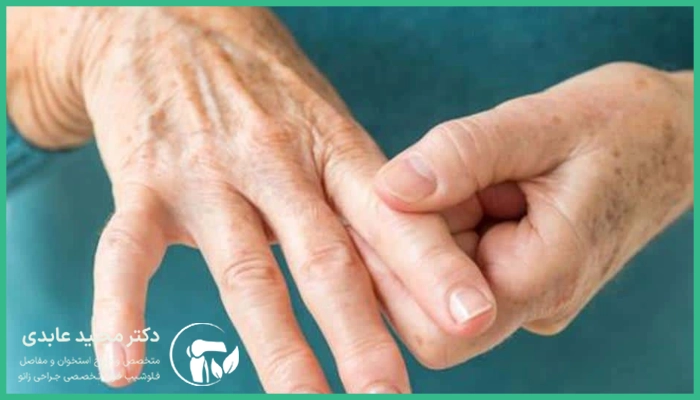 پیشگیری از روماتیسم مفصلی ممکن است؟