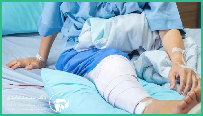عوارض شایع بعد از عمل رباط صلیبی