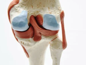 هزینه جراحی مینیسک زانو در شیراز