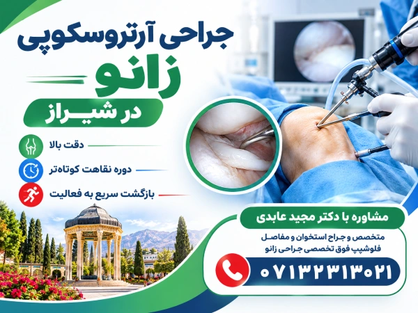 آرتروسکوپی زانو در شیراز