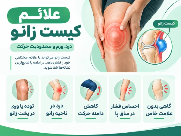تصویر اینفوگرافیک علائم کیست زانو
