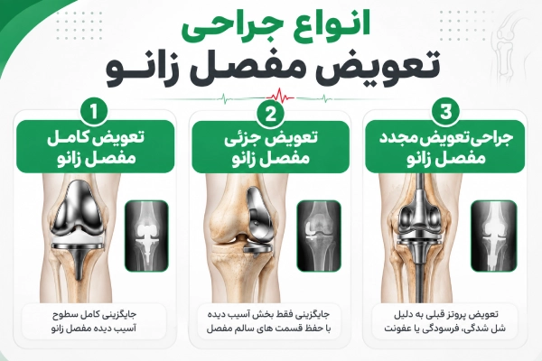 انواع جراحی تعویض مفصل زانو