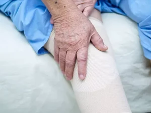 تعویض مفصل زانو در افراد دیابتی