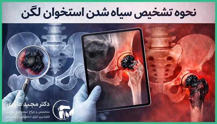 نحوه تشخیص سیاه شدن استخوان لگن