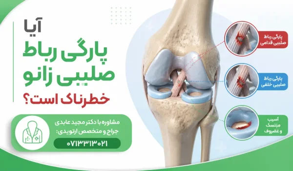 آیا پارگی رباط صلیبی خطرناک است — نمای آناتومیک رباطهای صلیبی و منیسک در مفصل زانو