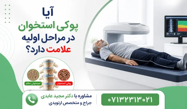 آیا پوکی استخوان در مراحل اولیه علامت دارد — انجام سنجش تراکم استخوان برای تشخیص پوکی استخوان