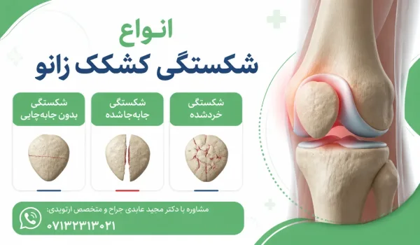 نمای آموزشی انواع شکستگی کشکک زانو شامل شکستگی بدون جابهجایی و جابهجا شده